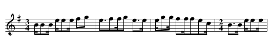Ag&uuml;ita de Putina - staff notation