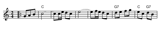 And the Angels Sing (der Shtiller Bulgar) - staff notation