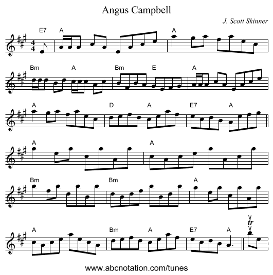 Angus Campbell - staff notation