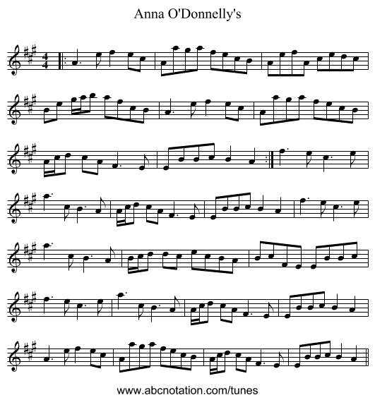 Anna O'Donnelly's - staff notation