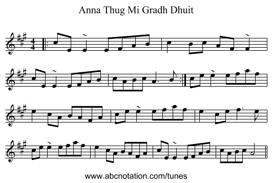 Anna Thug Mi Gradh Dhuit - staff notation