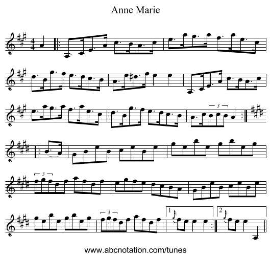 Anne Marie - staff notation