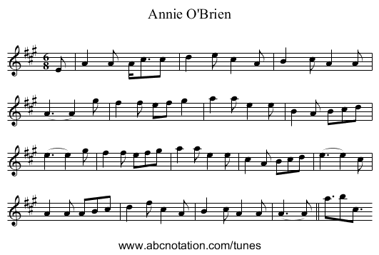 Annie O'Brien - staff notation