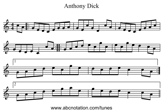Anthony Dick - staff notation