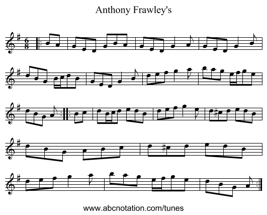 Anthony Frawley's - staff notation