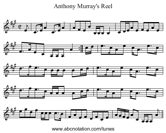 Anthony Murray's Reel - staff notation