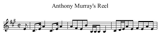 Anthony Murray's Reel - staff notation