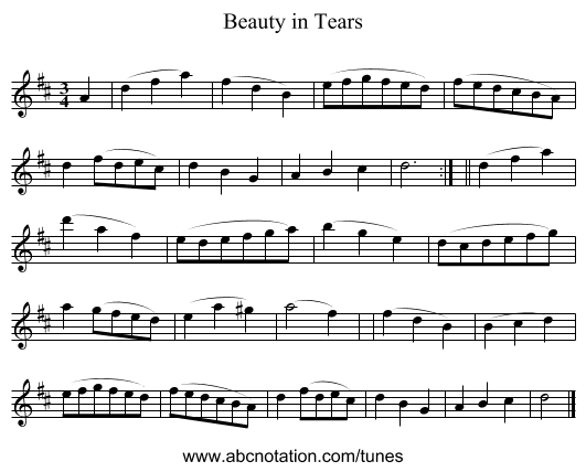 Beauty in Tears - staff notation
