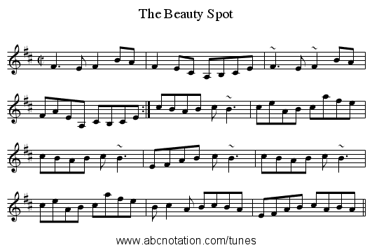Beauty Spot, The - staff notation
