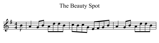 Beauty Spot, The  - staff notation