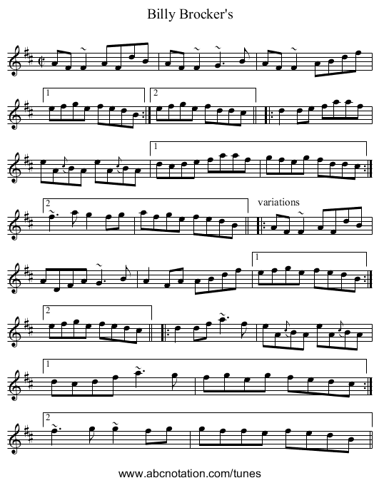 Billy Brocker's - staff notation