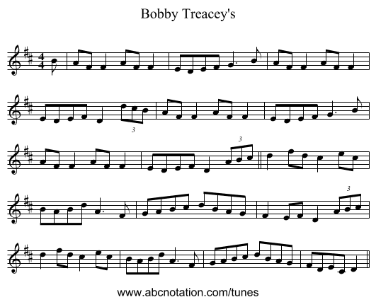 Bobby Treacey's - staff notation