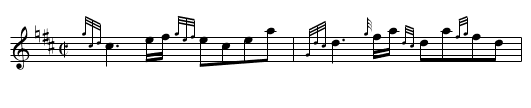 Bogallan - staff notation