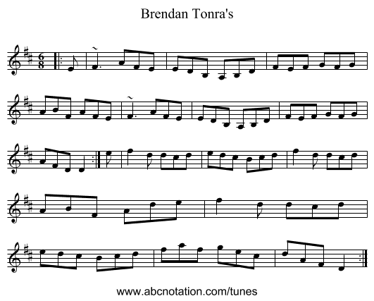 Brendan Tonra's - staff notation