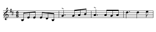 Bundle and Go - staff notation