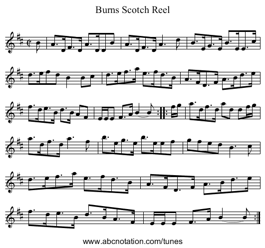 Burns Scotch Reel - staff notation
