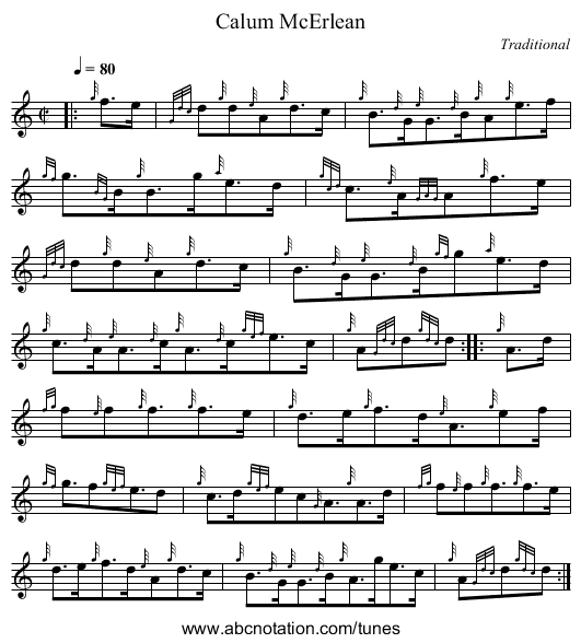 Calum McErlean - staff notation