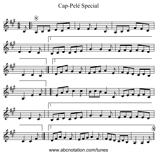 Cap-Pelé Special - staff notation