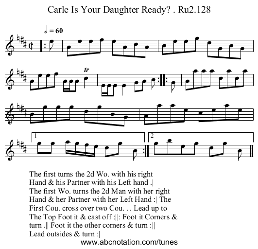 Carle Is Your Daughter Ready? . Ru2.128 - staff notation