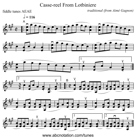 Casse-reel From Lotbiniere - staff notation