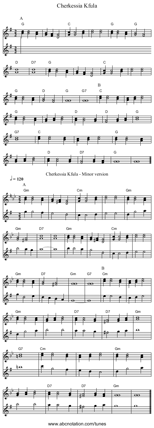 Cherkessia Kfula - staff notation