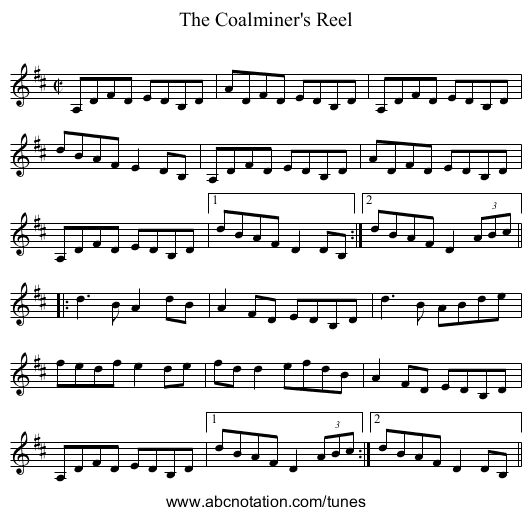 Coalminer's Reel, The - staff notation