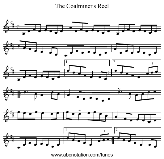 Coalminer's Reel, The - staff notation