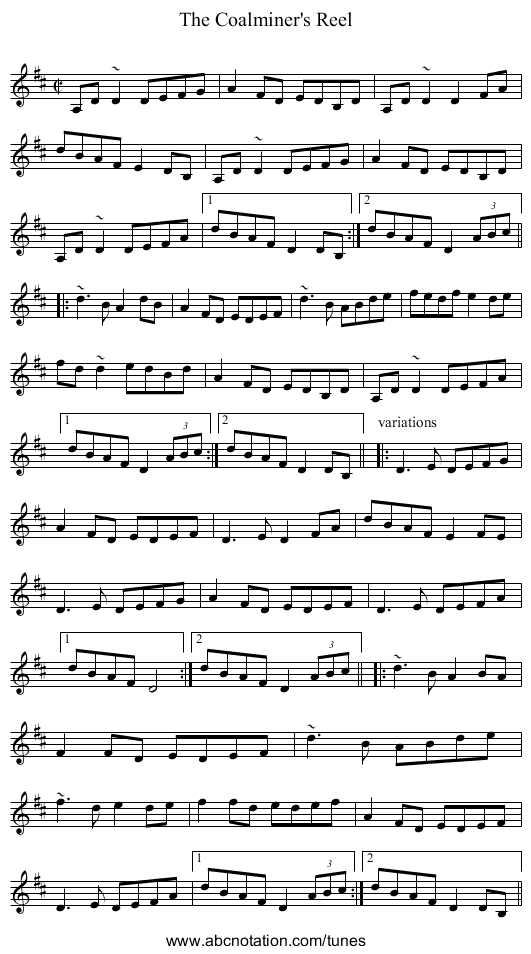 Coalminer's Reel, The - staff notation