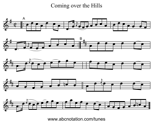 Coming over the Hills - staff notation