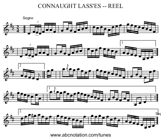 CONNAUGHT LASS'ES -- REEL - staff notation
