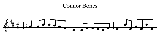 Connor Bones - staff notation