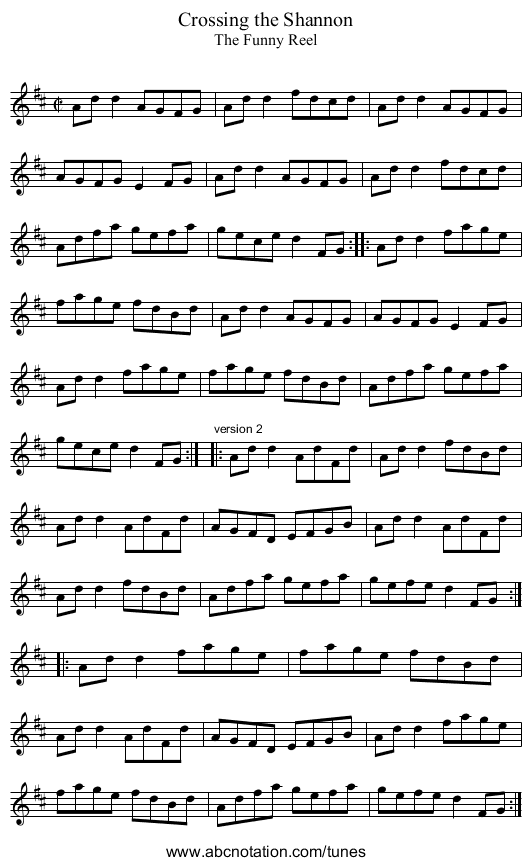 Crossing the Shannon - staff notation