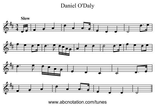 Daniel O'Daly - staff notation