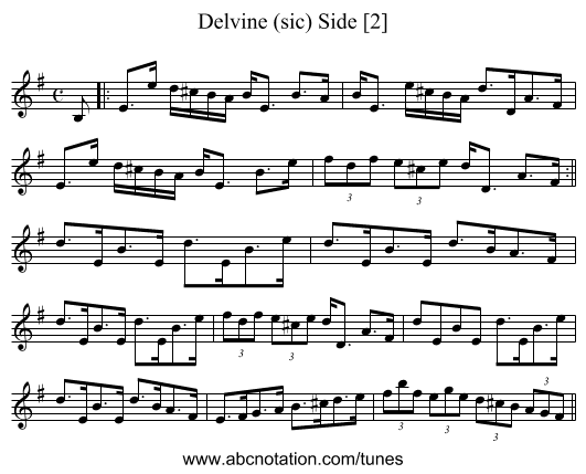 Delvine (sic) Side [2] - staff notation