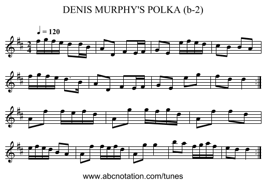 DENIS MURPHY'S POLKA (b-2) - staff notation