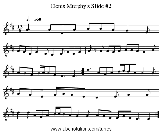 Denis Murphy's Slide #2 - staff notation