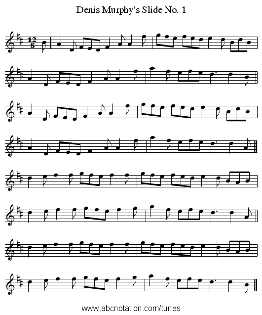 Denis Murphy's Slide No. 1 - staff notation