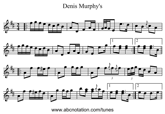 Denis Murphy's - staff notation