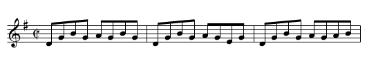 Denis Murphy's - staff notation