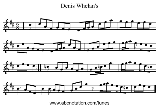 Denis Whelan's - staff notation