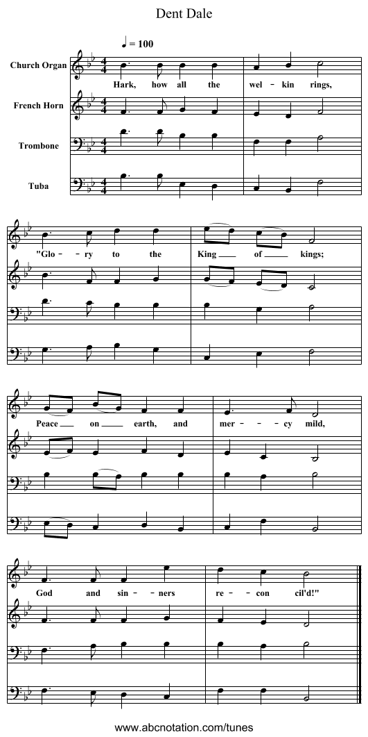 Dent Dale - staff notation