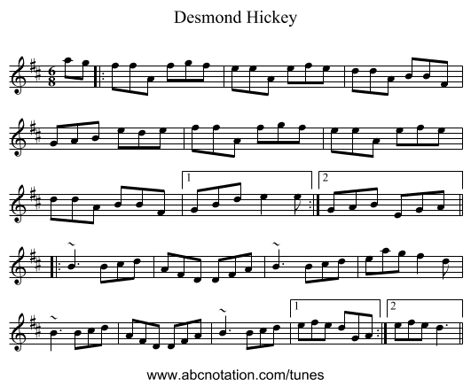 Desmond Hickey - staff notation