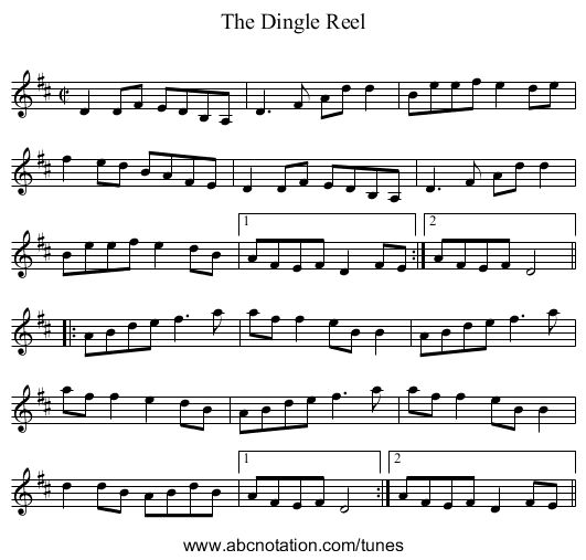 Dingle Reel, The - staff notation