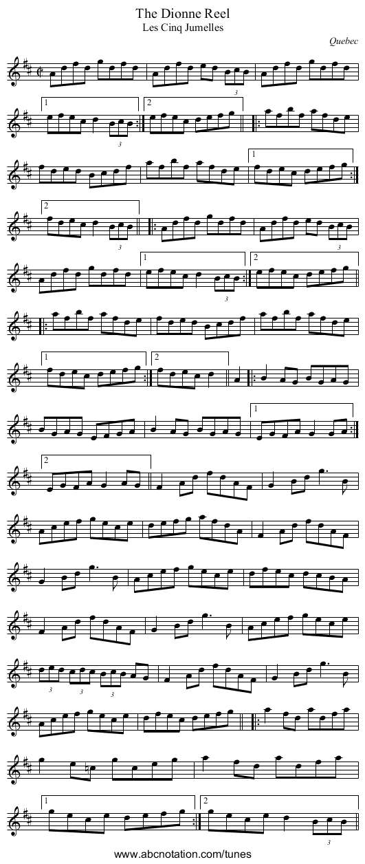 Dionne Reel, The - staff notation