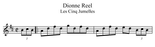 Dionne Reel - staff notation