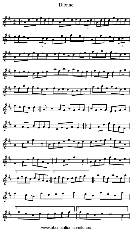 Dionne - staff notation