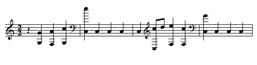 Dirty old town - staff notation