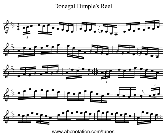 Donegal Dimple's Reel - staff notation