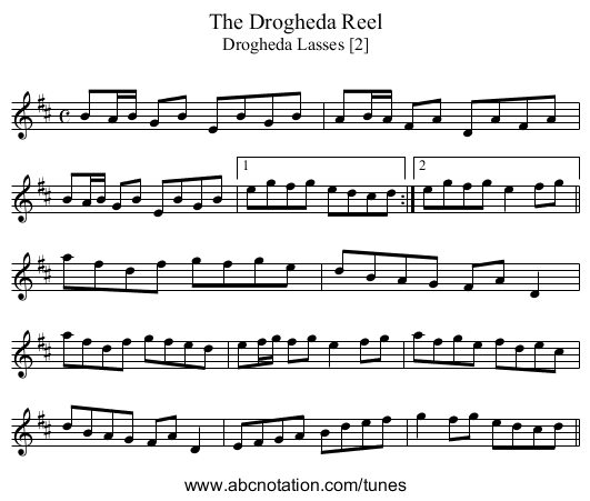 Drogheda Reel, The - staff notation