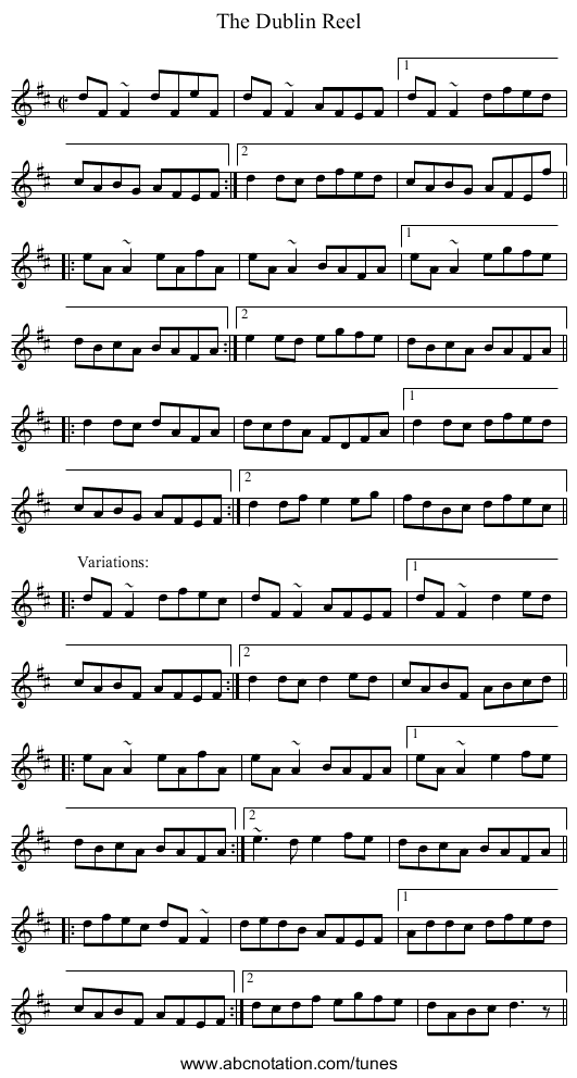 Dublin Reel, The - staff notation